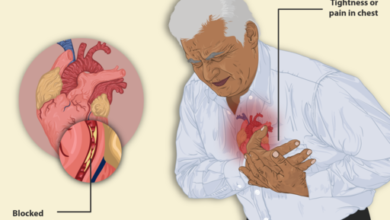 التغييرات التي ستحدثها بعد السكتة بالقلب - What changes will happen after a heart attack?