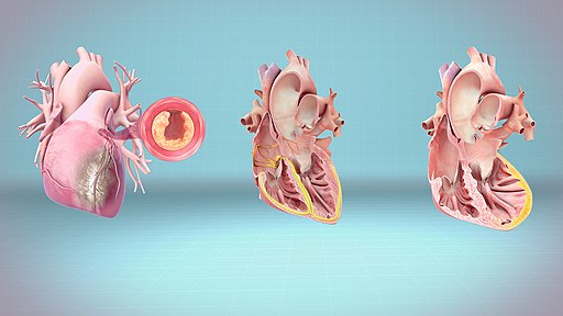 كيف تؤثر أمراض القلب على جسمك- How does heart disease affect your body?