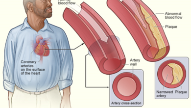 الرجال و امراض القلب - Men and heart disease