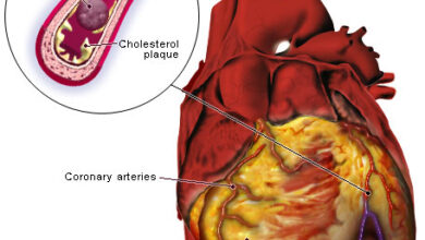 اثنا عشر دليل قد يكون لديك مرض في القلب - Twelve clues you may have heart disease