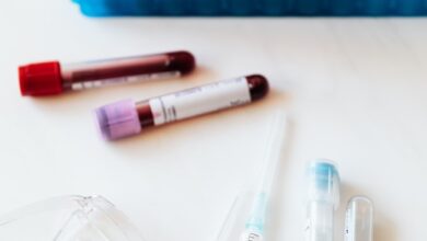 blood and urine test results