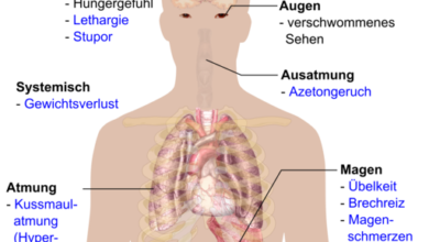 الاعراض والعلامات المبكرة لمرض السكري Early signs and symptoms of diabetes