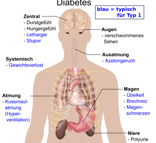 الاعراض والعلامات المبكرة لمرض السكري Early signs and symptoms of diabetes