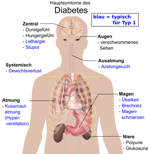 الاعراض والعلامات المبكرة لمرض السكري Early signs and symptoms of diabetes