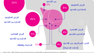 سرطان الثدي breast cancer