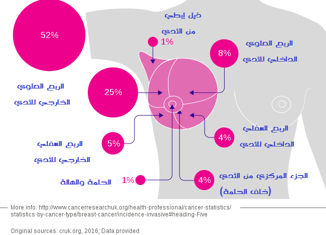 سرطان الثدي breast cancer