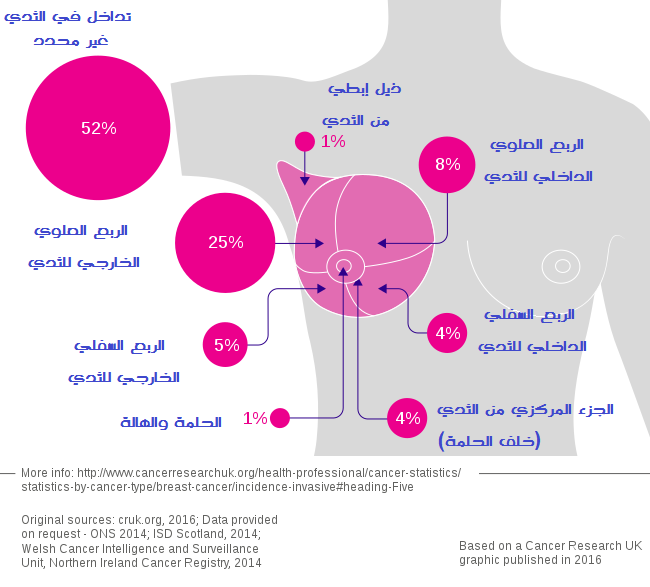 سرطان الثدي breast cancer