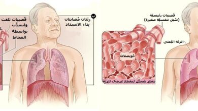 مرض الانسداد الرئوي المزمن chronic obstructive pulmonary disease